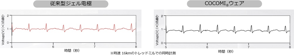 計測精度