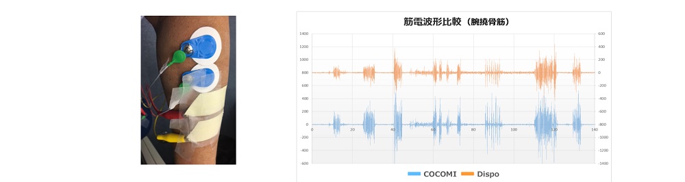 計測精度